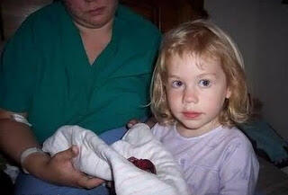 Subhanallah.. janin Berumur 15 Minggu Tapi Masih Bisa Hidup Sampai Saat Ini