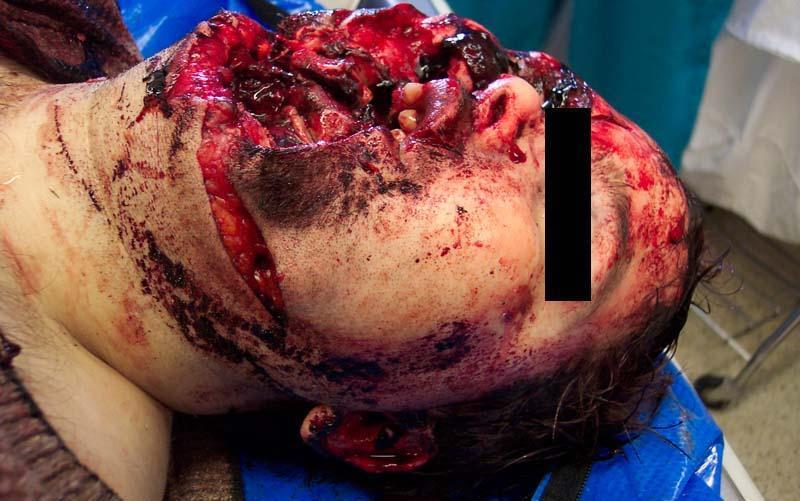 ๏[-ิ_&bull;ิ]๏ Ketika Kepala Kecium Shotgun . . . ! ! !๏[-ิ_&bull;ิ]๏