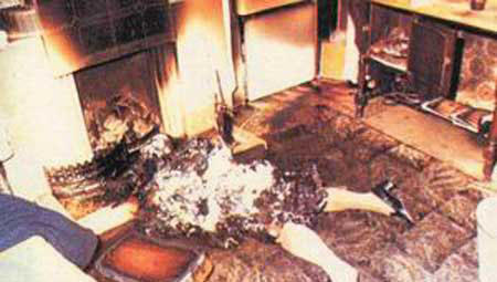 Spontaneous Human Combustion