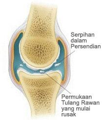 Ternyata Membunyikan Tulang Sendi Bahaya Loh Gan!