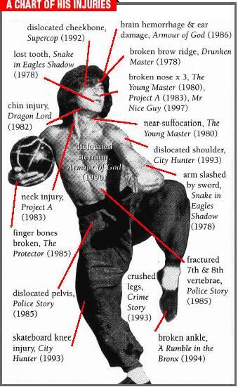 10 Kecelakan TERPARAH Jackie Chan