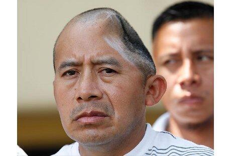 Kisah Pria yang Kehilangan Seperempat Kepala