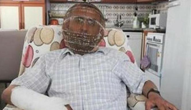 Ingin Stop Merokok, Pria Turki "Kandangkan" Kepalanya