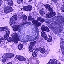 Bakteri-Bakteri Yang Hidup Di Dalam Air Minum