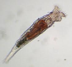 Bakteri-Bakteri Yang Hidup Di Dalam Air Minum