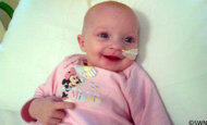Bayi Ini Tetap Tersenyum Walau Menderita Tujuh Tumor