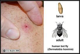 Hewan Parasit Yang Berbahaya