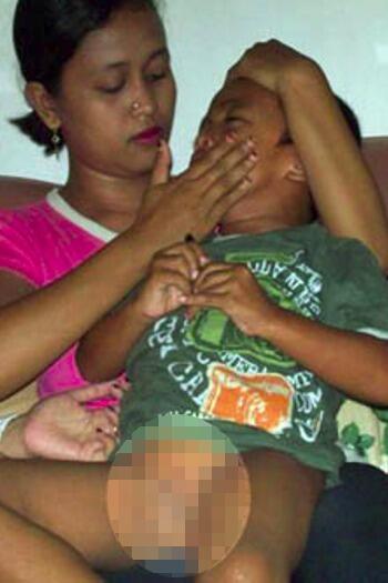 Hermafrodit. Manusia Yang Terlahir dengan 2 Jenis Kelamin