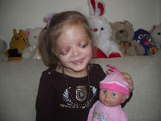 Pemilik 5 Mata Teraneh di Dunia gan..