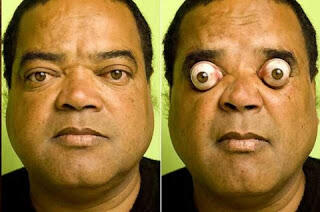 Pemilik 5 Mata Teraneh di Dunia gan..