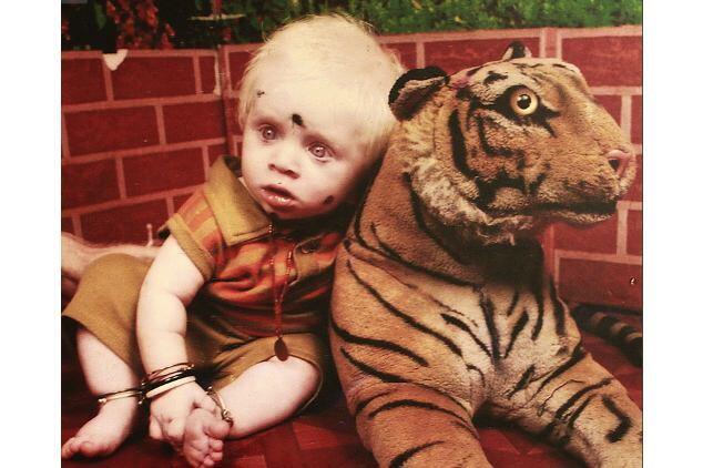 &#91;PICS&#93; Mengintip Kehidupan Keluarga Albino Terbesar di Dunia