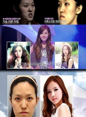 Sering Dicaci Berwajah Jelek, Gadis Ini Operasi Mirip Jessica SNSD