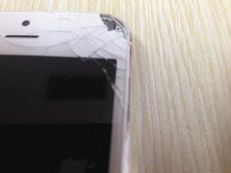 Lagi!!! iPhone 5 Meledak dan Sekarang Lukai Mata Pemiliknya