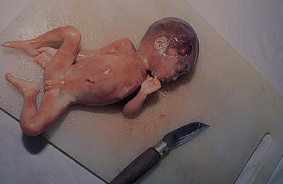 Janin Bayi Dijadikan Makanan Soup 