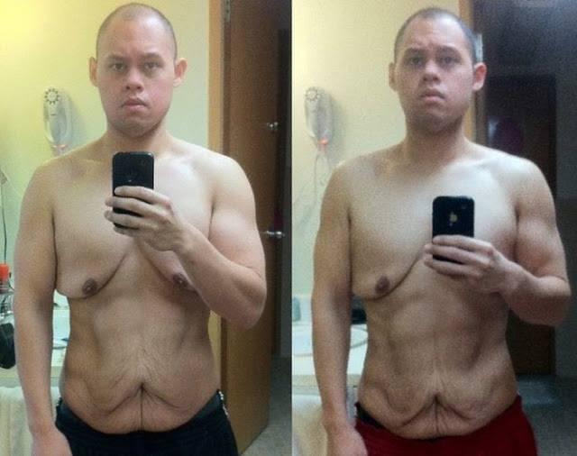 Parah ! Orang ini Sukses Diet Tapi Bentuk Badan jadi Kacau