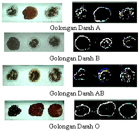 ARTI GOLONGAN DARAH DAN CARA BERKOMUNIKASINYA