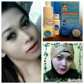 Beauty Rossa Paket Flek