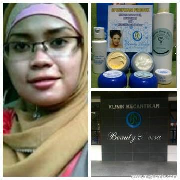 Beauty Rossa Paket Flek