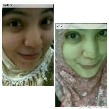 Beauty Rossa Paket Flek
