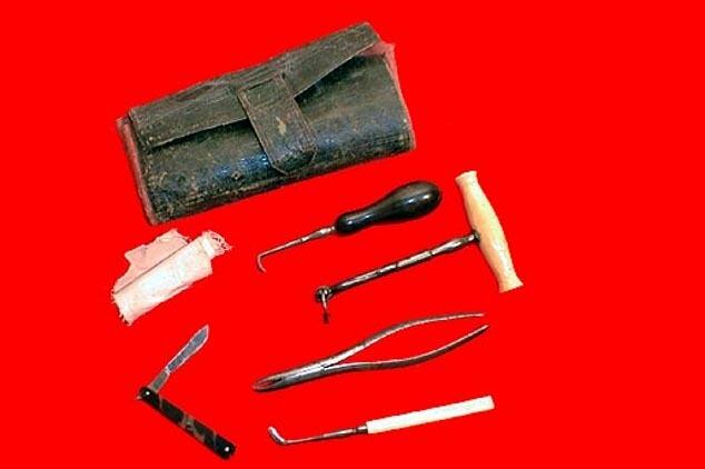 Alat Pencabut Gigi dari Masa ke Masa