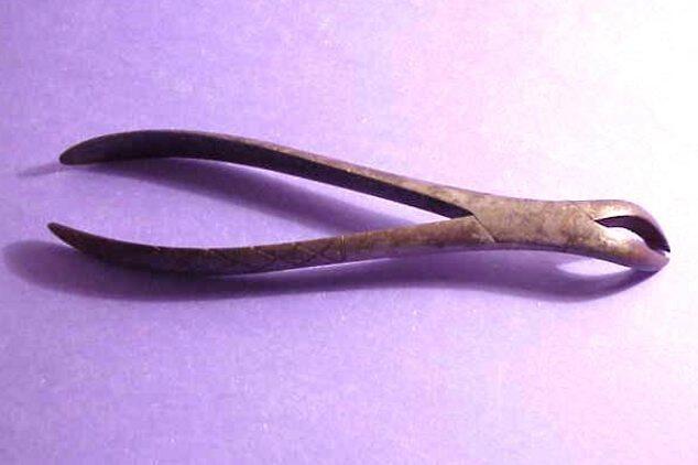 Alat Pencabut Gigi dari Masa ke Masa