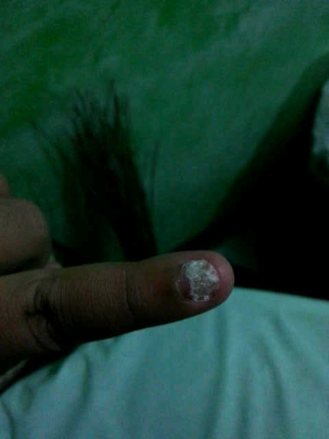 Help Gan! Kuku Ane Kenapa Yah?! :'(