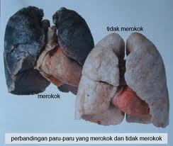 dibaca dulu gan.... buat paru-paru ente nih...