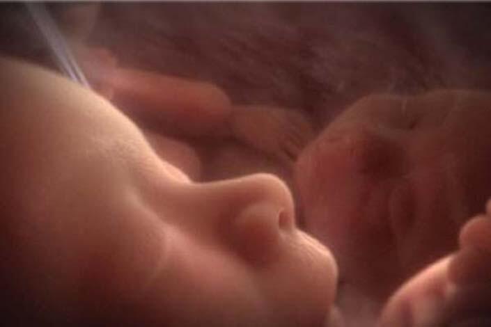 Sebuah Percakapan Antar Bayi Kembar Di Rahim Ibu