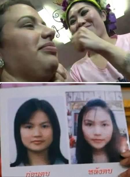 9 Terapi Paling Aneh di Dunia, Berani Mencoba?