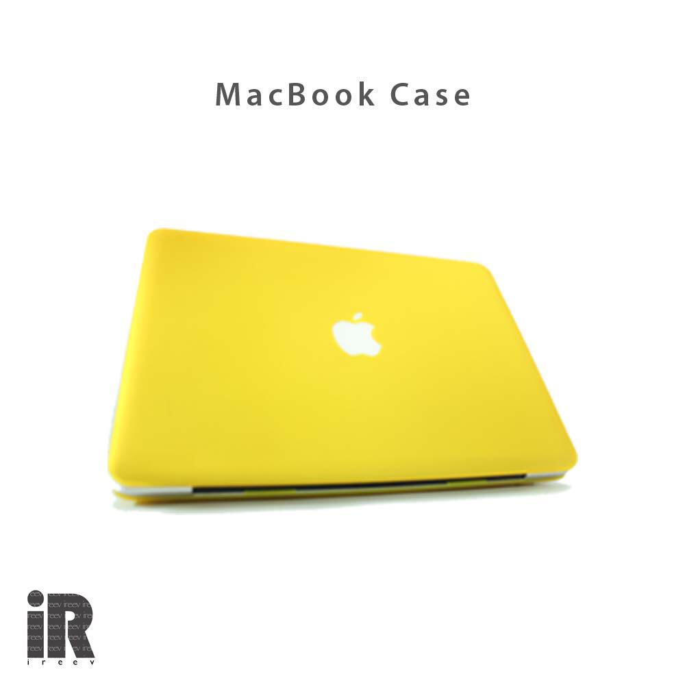 &#91;IREEV&#93; Ready Case Macbook for your Macbook 