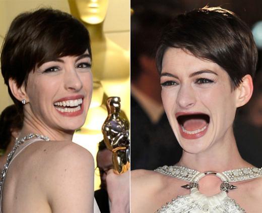 9 Selebriti Hollywood Ini Mendadak Ompong