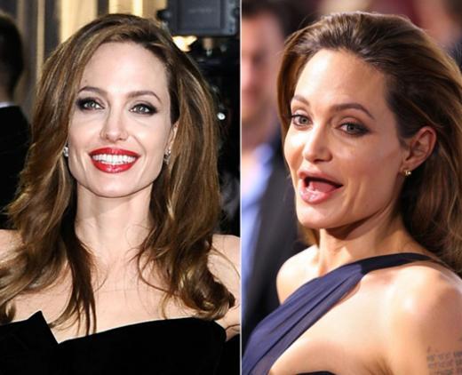 9 Selebriti Hollywood Ini Mendadak Ompong