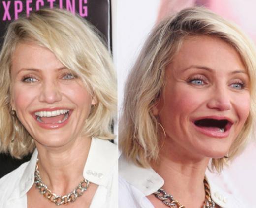 9 Selebriti Hollywood Ini Mendadak Ompong