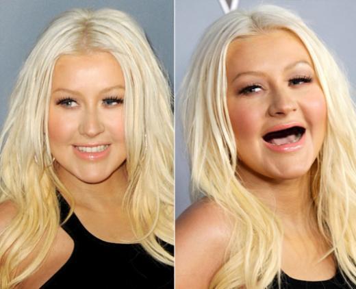 9 Selebriti Hollywood Ini Mendadak Ompong