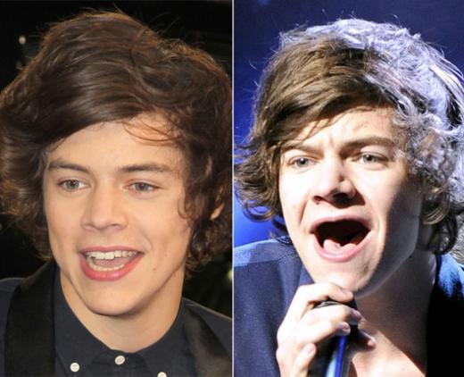 9 Selebriti Hollywood Ini Mendadak Ompong