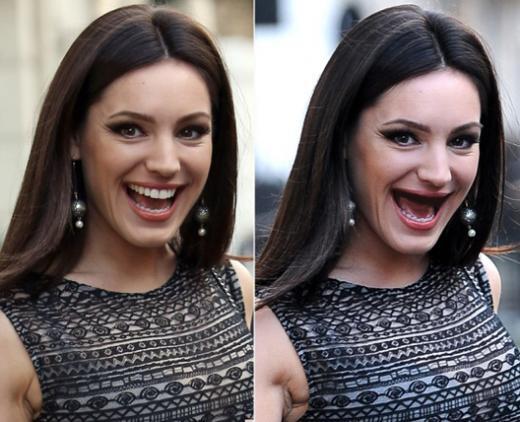9 Selebriti Hollywood Ini Mendadak Ompong