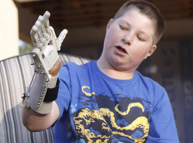 Robohand, Tangan Robotik yang Dibuat dengan Printer 3D