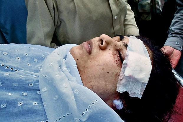 perjuangan gadis pakistan demi pendidikan meskipun tertebmak di kepala (malala)