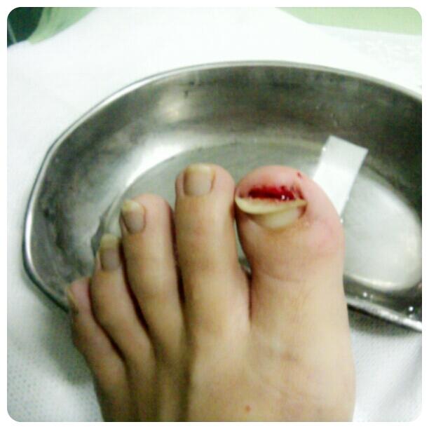 Bahaya dari Kuku Kaki Panjang (Aganwati sini masuk) 