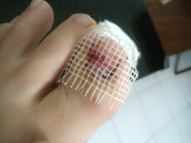 Bahaya dari Kuku Kaki Panjang (Aganwati sini masuk) 