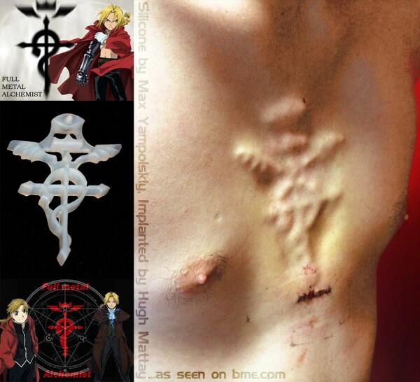 &#91;AGAK BB&#93; Segala Tentang 3D Implants / Body Modification