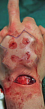 &#91;AGAK BB&#93; Segala Tentang 3D Implants / Body Modification