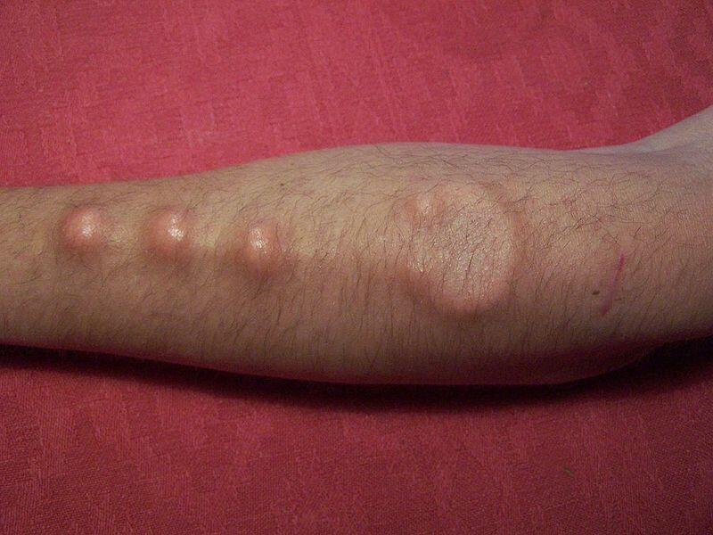 &#91;AGAK BB&#93; Segala Tentang 3D Implants / Body Modification