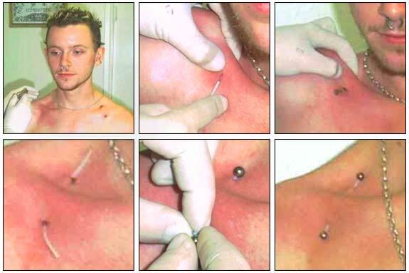 &#91;AGAK BB&#93; Segala Tentang 3D Implants / Body Modification
