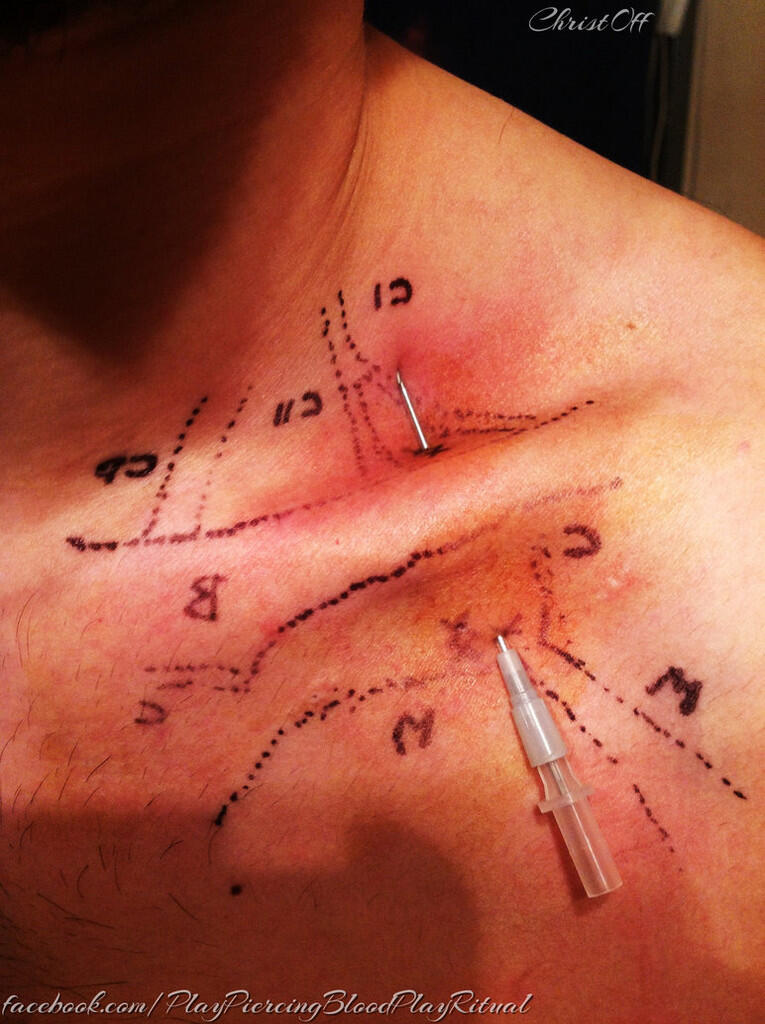 &#91;AGAK BB&#93; Segala Tentang 3D Implants / Body Modification