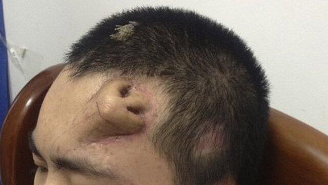 wwwow Agan Ini Punya Hidung Di Kepala