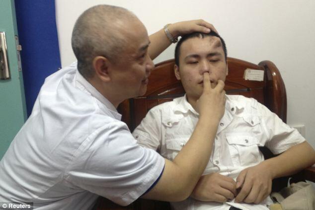 Hidung Baru `Tumbuh` di Dahi Pria China