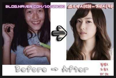 Before and After Personil SNSD