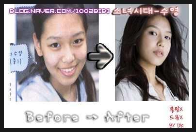 Before and After Personil SNSD