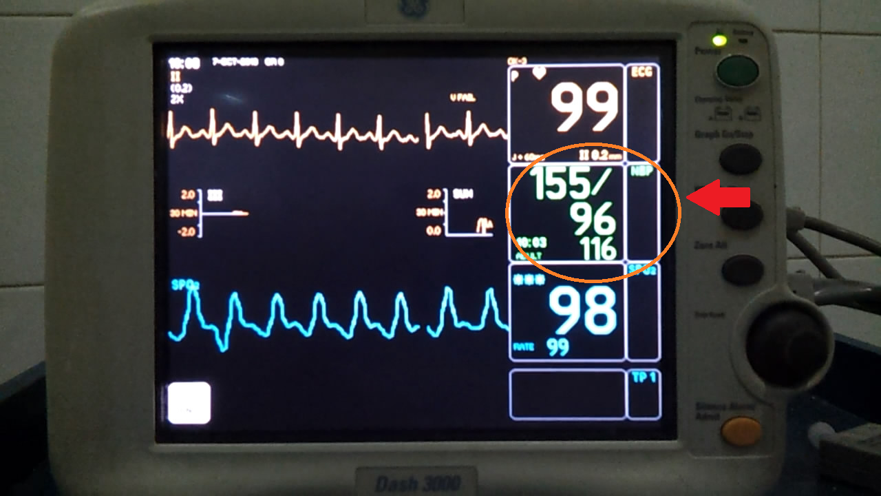 Mengenal Bedside Monitor  KASKUS